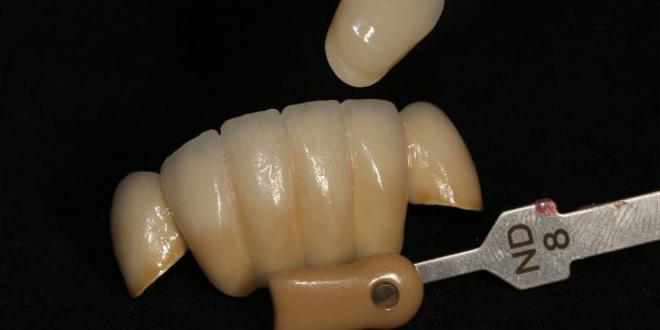Dental Crowns and Bridges ND 8